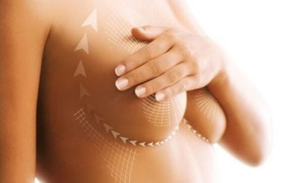 soulever la suture pour une augmentation mammaire